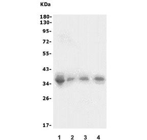 Western blot testing of 1) human HEK293, 2) rat thymus, 3) rat spleen and 4) mouse spleen lysate wit
