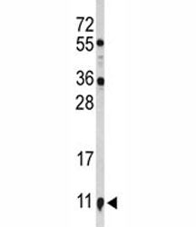 S100A10 Antibody