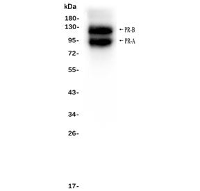 Western blot testing of human T-47D cell lysate with Progesterone Receptor antibody. Expected molecu