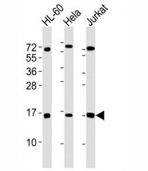 Western blot testing of SUMO1 antibody at 1:4000 dilution. Lane 1: HL-60 lysate; 2: HeLa lysate; 3: 