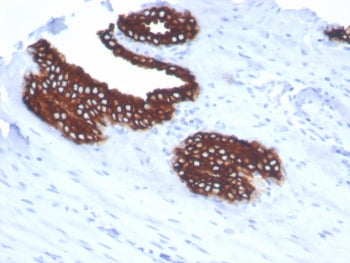 IHC staining of FFPE human prostate tissue with Keratin 18 antibody (clone KRT18/7056R). HIER: boil 
