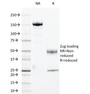 HLA-DR Antibody (MHC II)