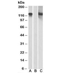 Western blot testing of HEK293 lysate overexpressing CDH11-MYC with CDH11 antibody [1ug/ml] in Lane 