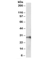 Western blot testing of pig kidney lysate with HOXA5 antibody at 1ug/ml. Predicted molecular weight: