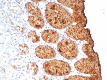 TAG-72 Antibody