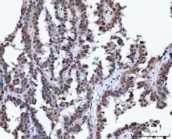 X-ray repair cross-complementing 4 Antibody / XRCC4