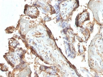 IHC: Formalin-fixed, paraffin-embedded human placenta stained with hCG Holo antibody (clone HCGab/52