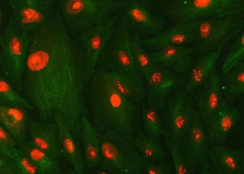SMC1A Antibody / Structural maintenance of chromosomes protein 1A
