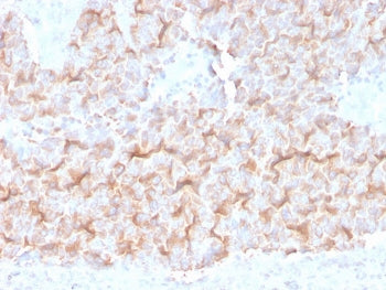 IHC staining of FFPE human lung with Alpha Tubulin antibody (clone TUBA/3038). HIER: boil tissue sec