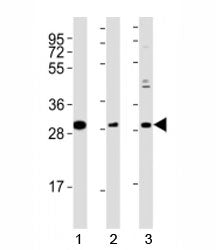 Nkx2.5 Antibody