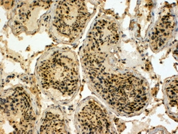 IHC testing of FFPE human testis with UBR5 antibody at 4ug/ml. HIER: steamed with pH9 Tris/EDTA buff