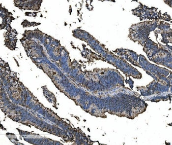 Astrin Antibody / SPAG5