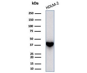STING1 Antibody / TMEM173 / ERIS / MITA