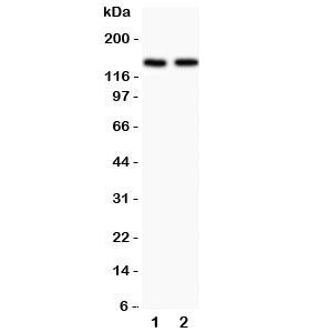 Hamartin Antibody