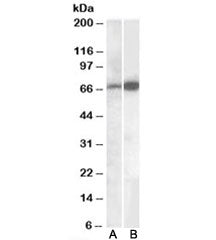 Western blot testing of human cerebellum lysate with CADM4 antibody A) cat # R34370 (0.1ug/ml) and B