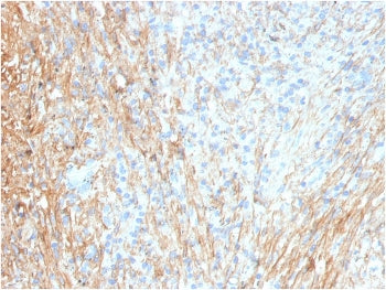 FN1 Antibody / Fibronectin