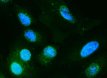 Immunofluorescent staining of FFPE human A549 cells with DIO1 antibody (green) and DAPI nuclear stai