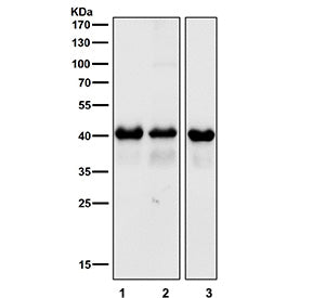 Western blot testing of 1) mouse brain, 2) mouse skin and 3) rat brain tissue lysate with TARDBP ant
