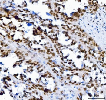 Transcription factor SP1 Antibody / Specificity protein 1