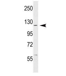 ABL1 Antibody