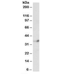 Western blot testing of human cerebellum lysate with NeuroD4 antibody at 1ug/ml. Predicted molecular
