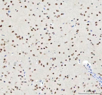 IHC staining of FFPE mouse brain tissue with TARDBP antibody. HIER: boil tissue sections in pH8 EDTA