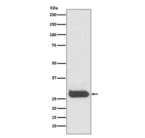 Western blot testing of human fetal brain lysate with THY1 antibody. Expected molecular weight 18~35