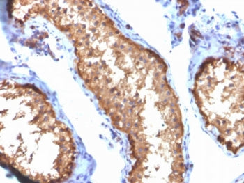 IHC testing of FFPE human testis tissue with Vinculin antibody (clone VCL/2572). HIER: boil tissue s