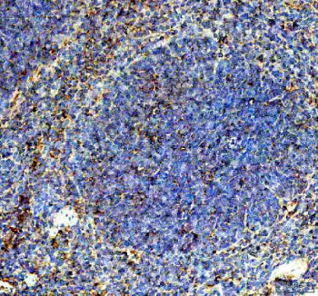 IHC staining of FFPE mouse spleen tissue with Cd244 antibody, HRP-secondary and DAB substrate. HIER: