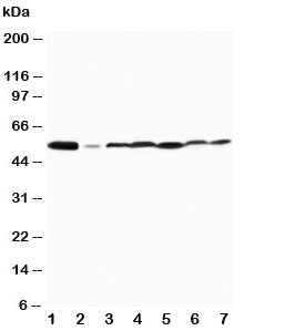 Western blot testing of MAPK8/9 antibody and Lane 1: rat brain; 2: rat thymus and human 3: MCF-7; 4: