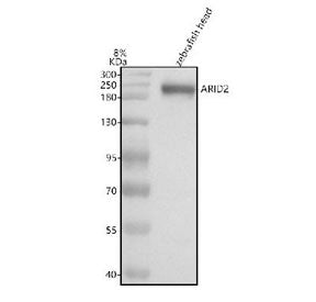Western blot analysis of Arid2 protein using zebrafish Arid2 antibody and zebrafish head tissue lysa