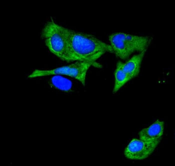Immunofluorescent staining of FFPE human U-2 OS cells with ATP11C antibody (green) and DAPI nuclear 