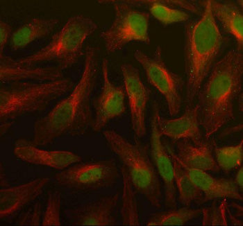 Immunofluorescent staining of PSMD5 using anti-PSMD5 antibody (green) and anti-Beta Tubulin antibody