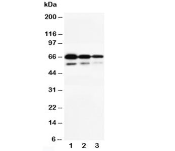 Western blot testing of CD34 antibody and Lane 1: Recombinant human CD34 protein 10ng; 2: 5ng; 3: 2.