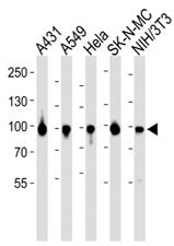 HSP90 Antibody