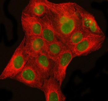 Immunofluorescent staining of FFPE human U-2 OS cells with DHX15 antibody (green) and Beta Tubulin m