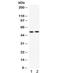 GABRB3 Antibody
