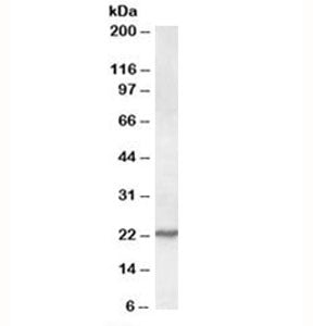 Western blot testing of NIH3T3 lysate with SAR1 antibody at 0.1ug/ml. Predicted molecular weight: ~2