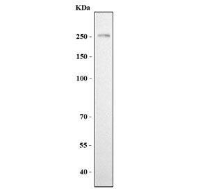 L1CAM Antibody / NCAM-L1 / CD171