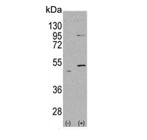 Western blot testing of 1) non-transfected and 2) transfected 293 cell lysate with ALDH5A1 antibody.