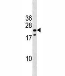 Nkx3.1 antibody western blot analysis in mouse stomach tissue lysate. Predicted molecular weight ~28