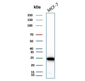Western blot testing of human MCF7 cell lysate with recombinant LGALS3 antibody (clone rLGALS3/7286)