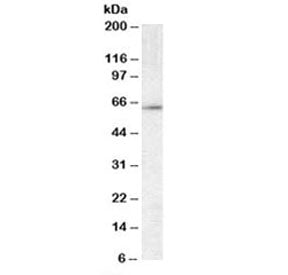 Western blot testing of mouse testis lysate with CCT3 antibody at 0.01ug/ml. Predicted molecular wei