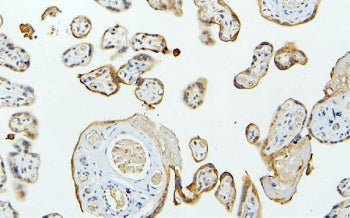 IHC staining of FFPE human placenta with MID1 antibody. HIER: boil tissue sections in pH6, 10mM citr