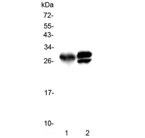 Western blot testing of 1) rat pancreas and 2) mouse pancreas with Kallikrein 1 antibody. Predicted 