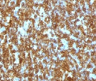 IHC testing of FFPE human tonsil and anti-CD45RA antibody (clone CDLA45RA-1). HIER: boil sections in