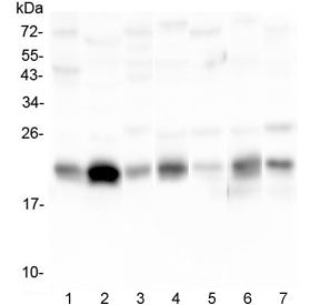 Western blot testing of 1) human placenta, 2) U-87 MG, 3) human HeLa, 4) rat stomach, 5) rat testis,