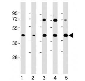 Western blot testing of Glycogenin antibody at 1:2000: Lane 1) human HeLa, 2) human HepG2, 3) mouse 