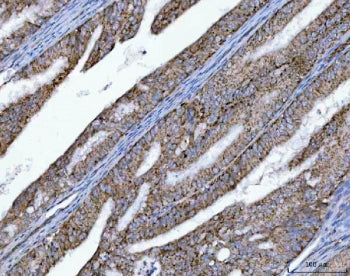 OXSM Antibody / 3 oxoacyl ACP synthase mitochondrial