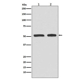 Western blot testing of lysate from human 1) HepG2 and 2) HeLa cells treated with etoposide, with ph